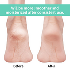 Anti Crack Silicon Gel Heel Moisturizing Socks for Foot Care Men Women (Loose Pack)